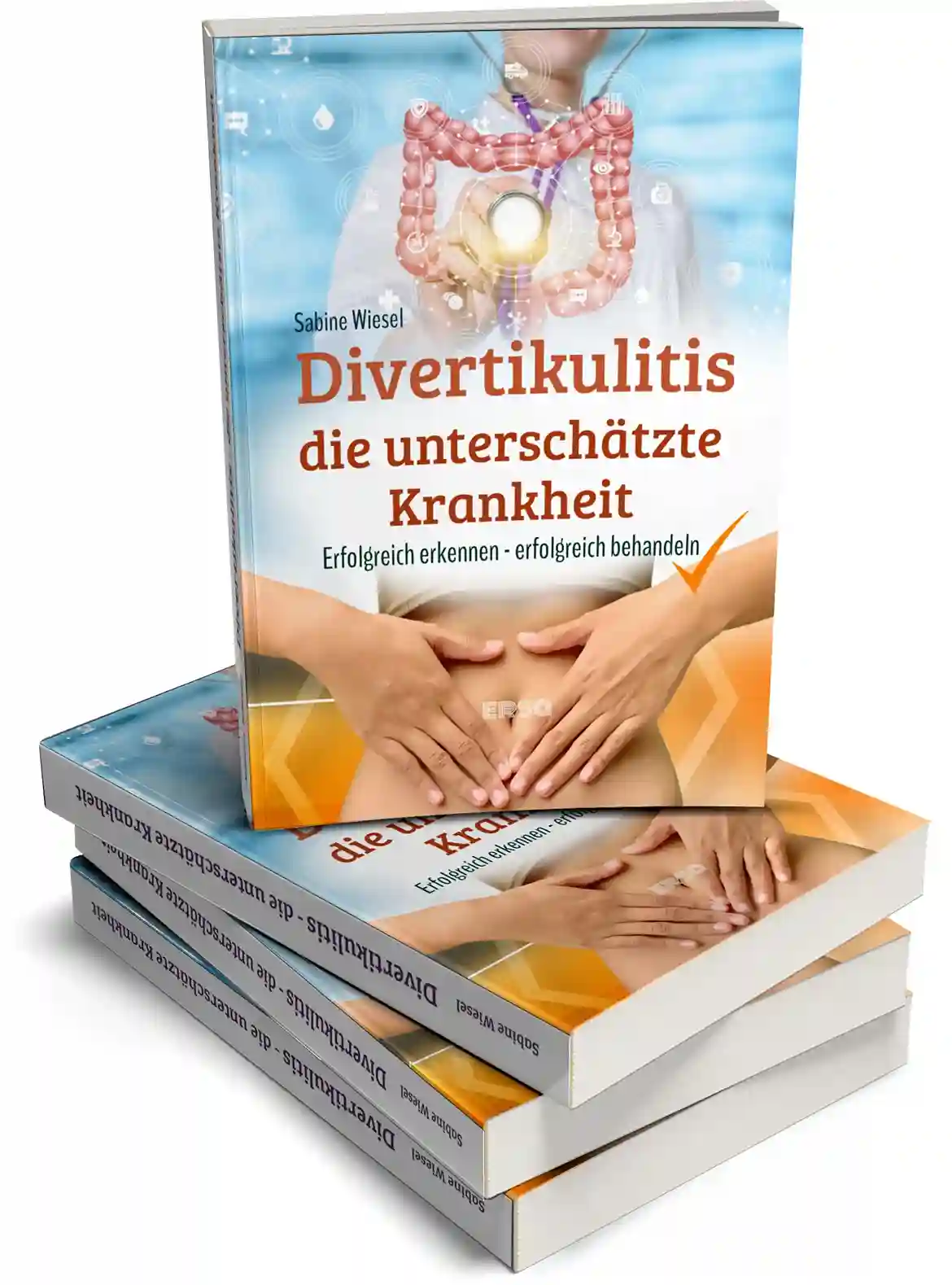 Divertikulitis die unterschätzte Krankheit